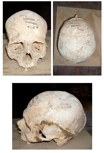 Мужской череп из погребения № 19 кургана № 3  могильника Кирилены (Молдова)